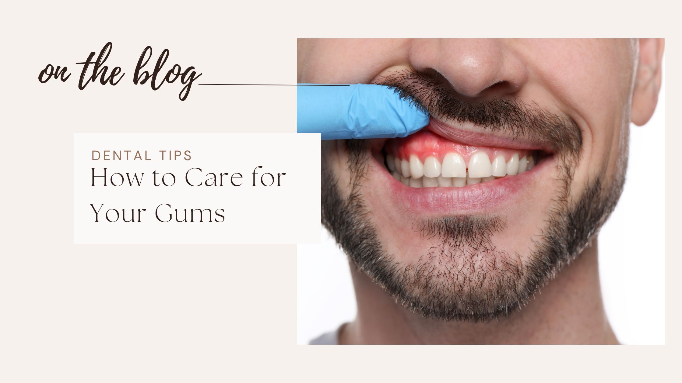 Take Care of Root Canal Treated Tooth