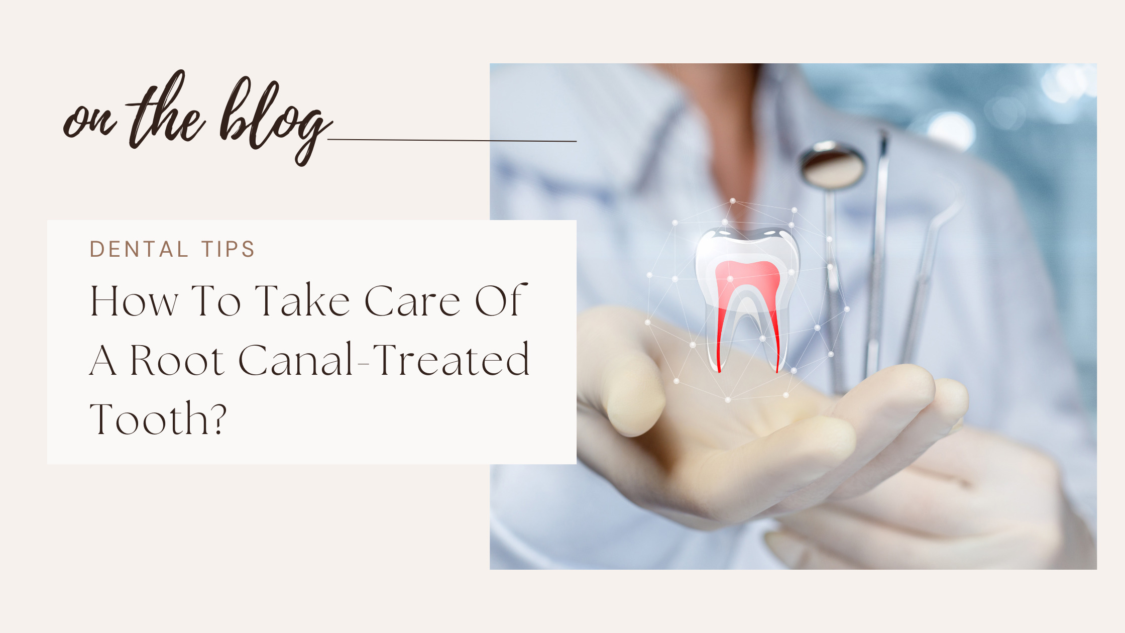 Take Care of Root Canal Treated Tooth